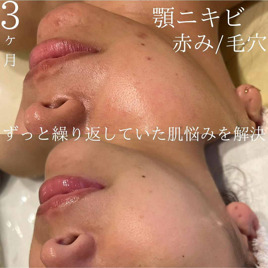 リアボーテ東京恵比寿エステサロンMa-Beauteマボーテの...