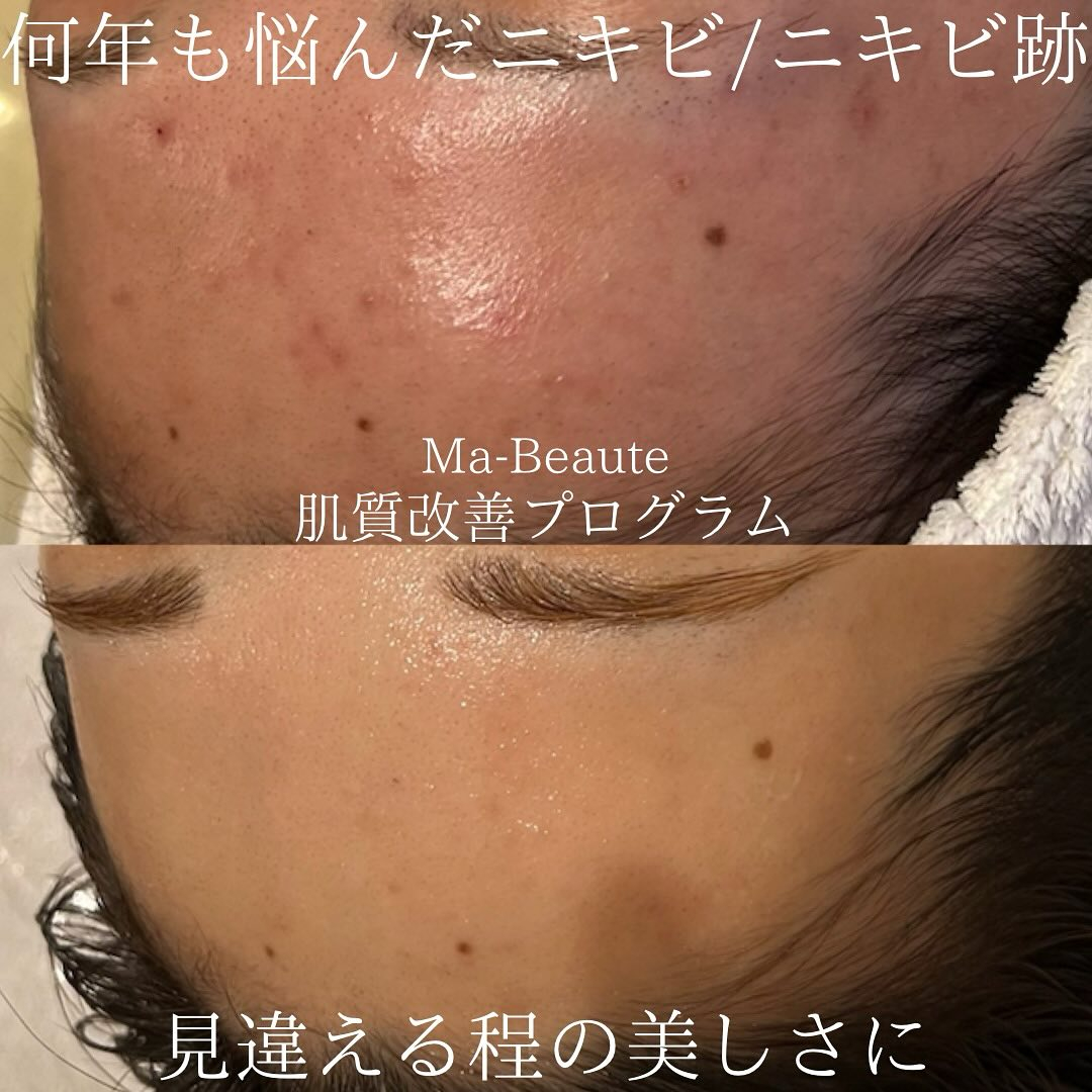 リアボーテ東京恵比寿エステサロンMa-Beauteマボーテの...