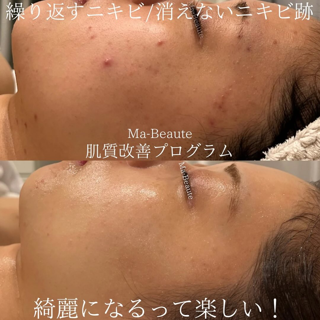 リアボーテ東京恵比寿エステサロンMa-Beauteマボーテの...