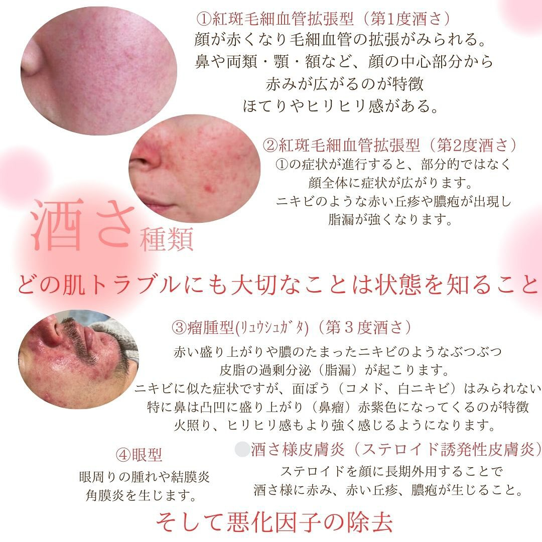 根本肌質改善リアボーテ東京恵比寿エステサロンMa-Beaut...