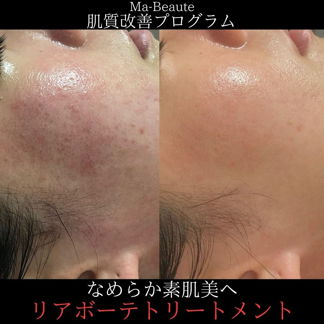 リアボーテ恵比寿エステサロンのMa-Beauteマボーテです...