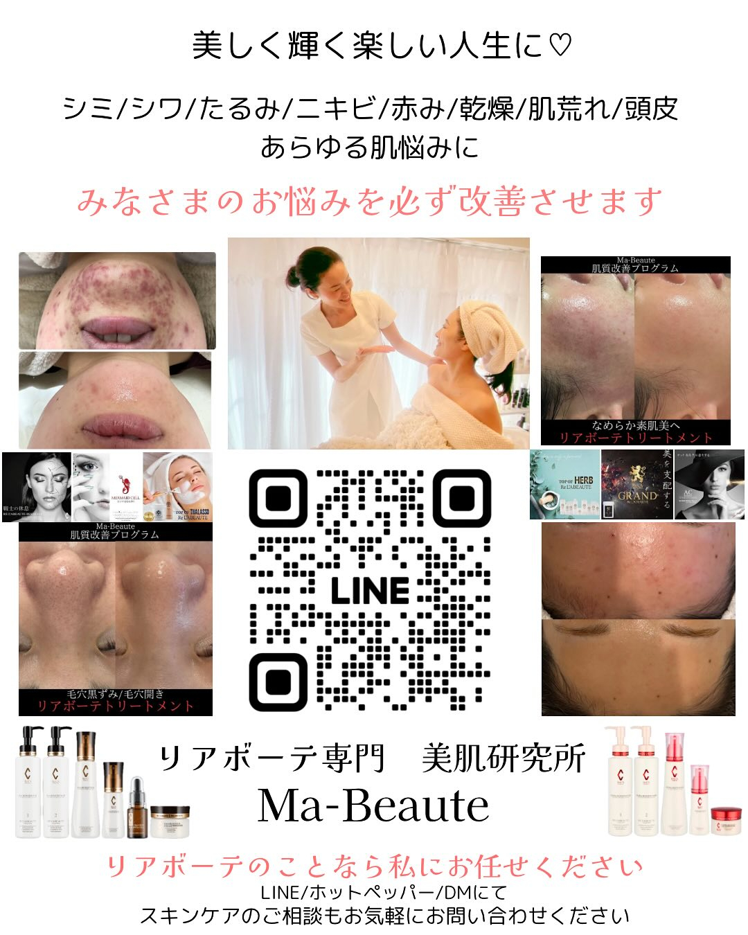 リアボーテのインナーケアが手放せない♡リアボーテ専門美肌研究...