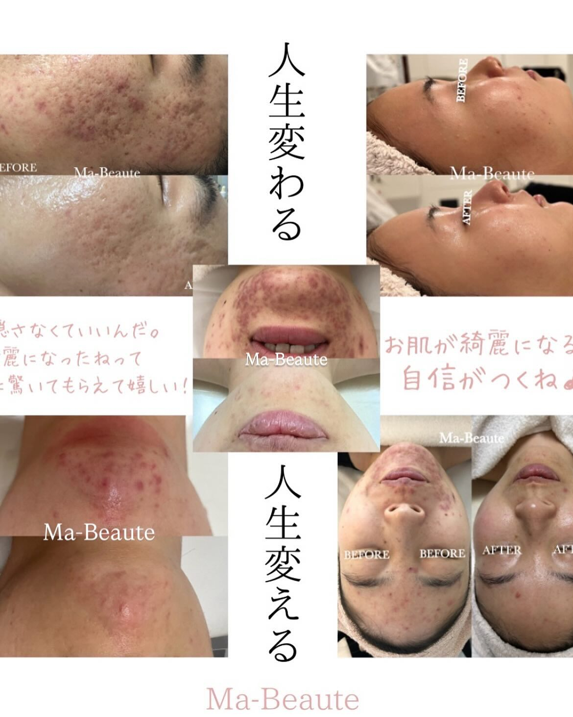 お肌悩みをお聞かせください☺️綺麗を目指す皆様へ🫧