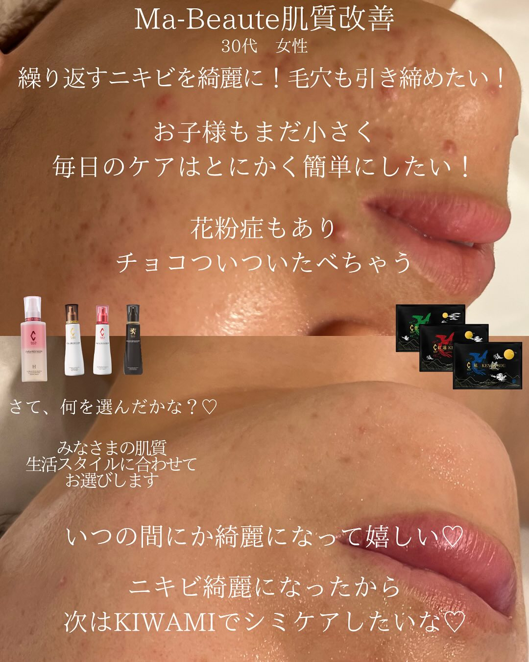 リアボーテ専門美肌研究所Ma-Beauteマボーテです💆♀...