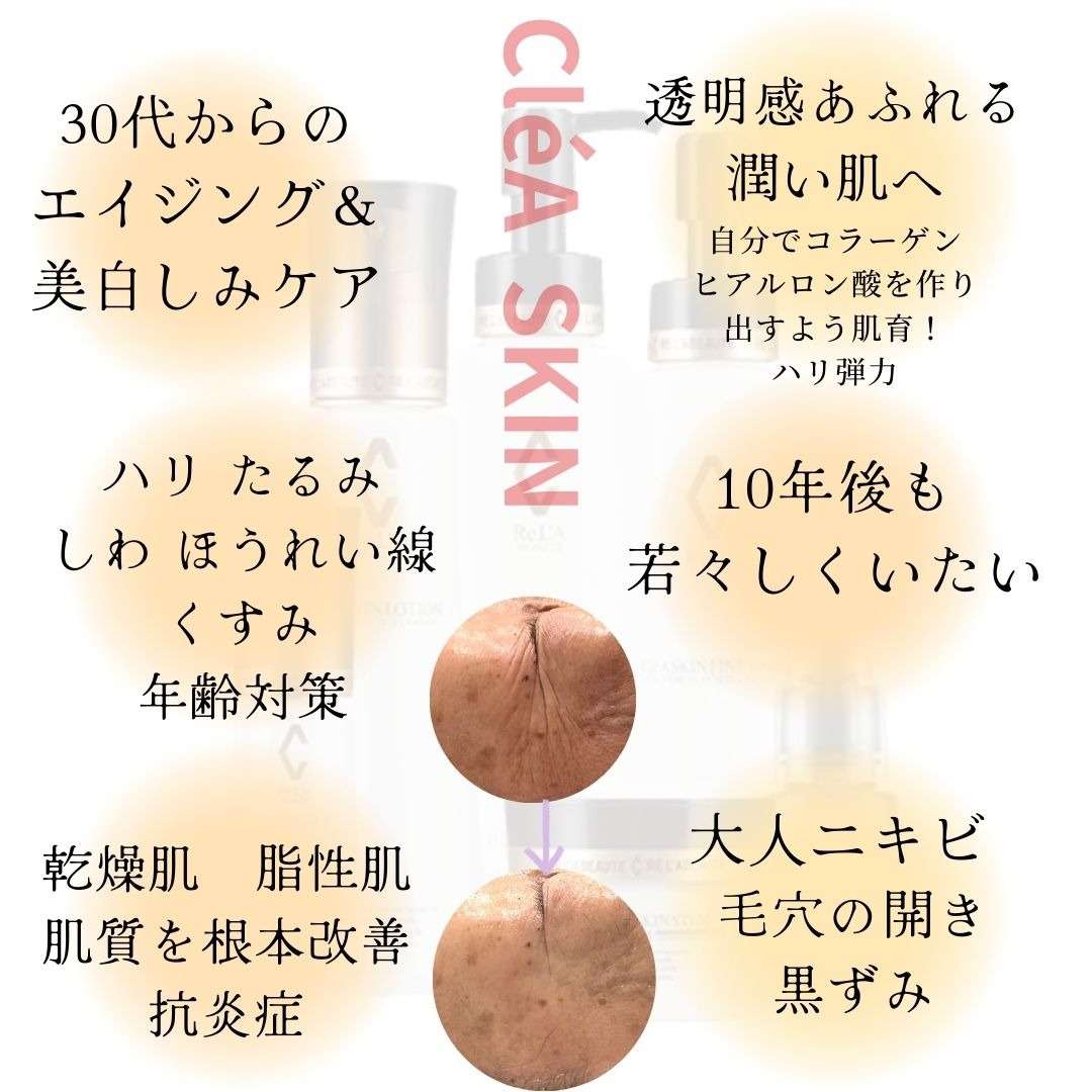 アンチエイジング/シミ/大人ニキビ