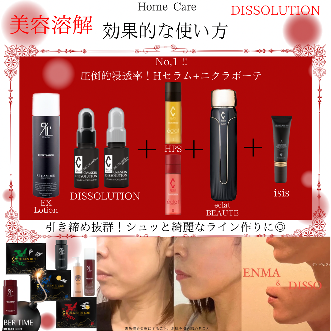 DISSOLUTION（ディゾセラム）