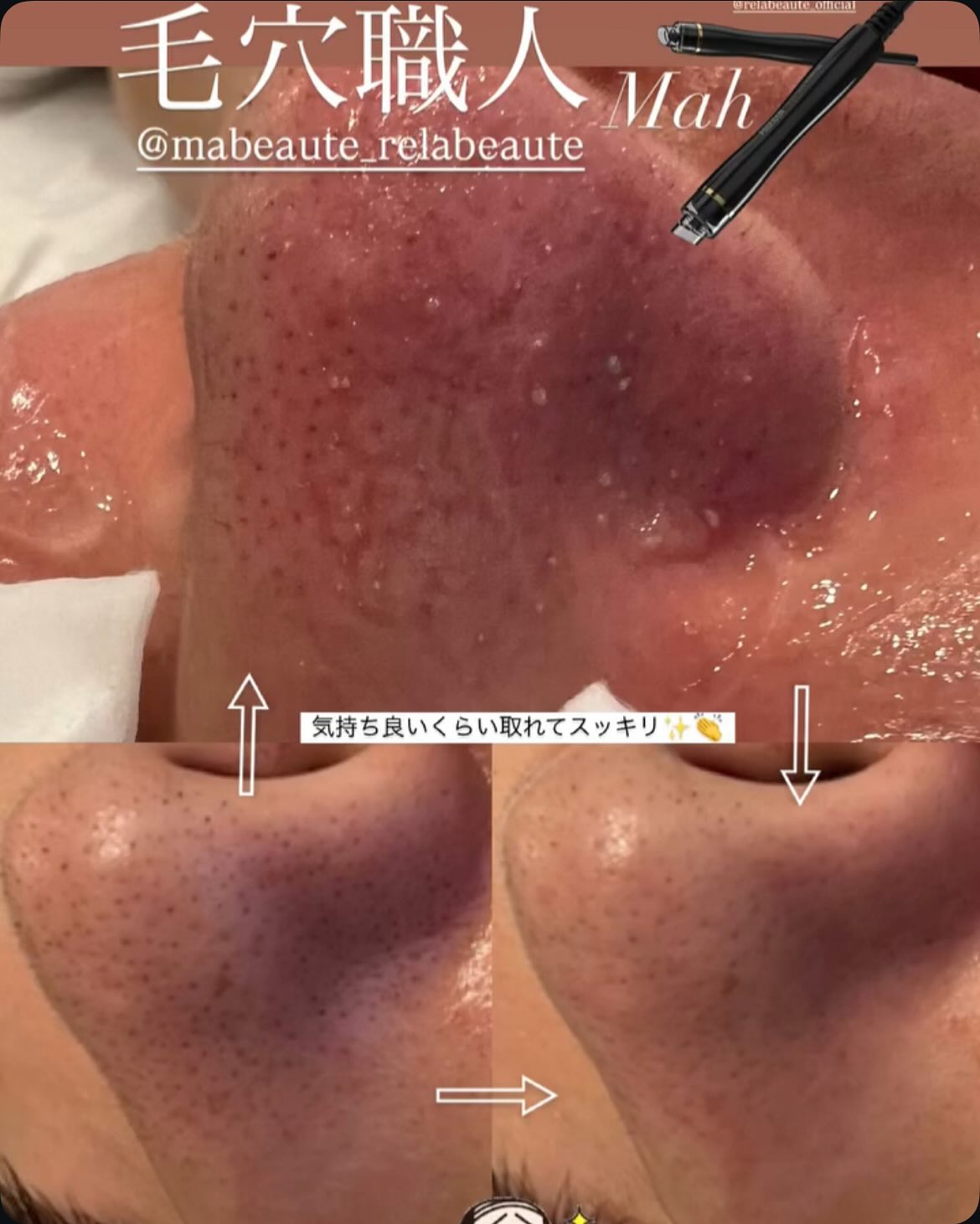 リアボーテKIWAMIケア