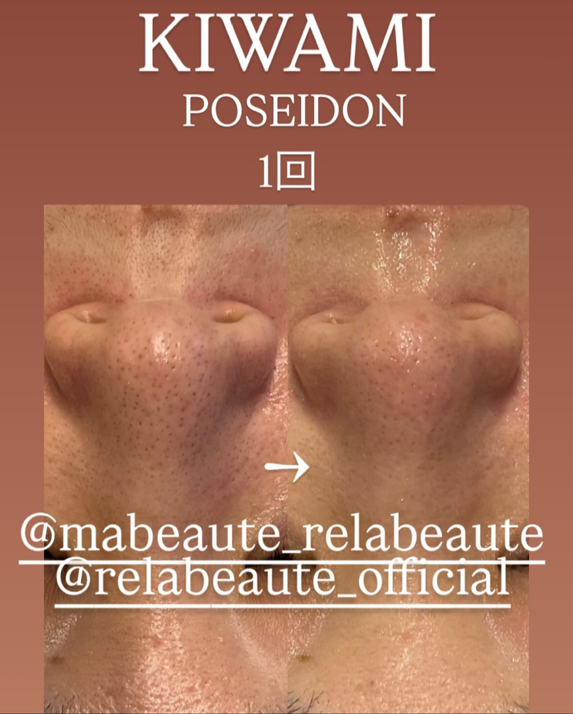 リアボーテKIWAMIケア