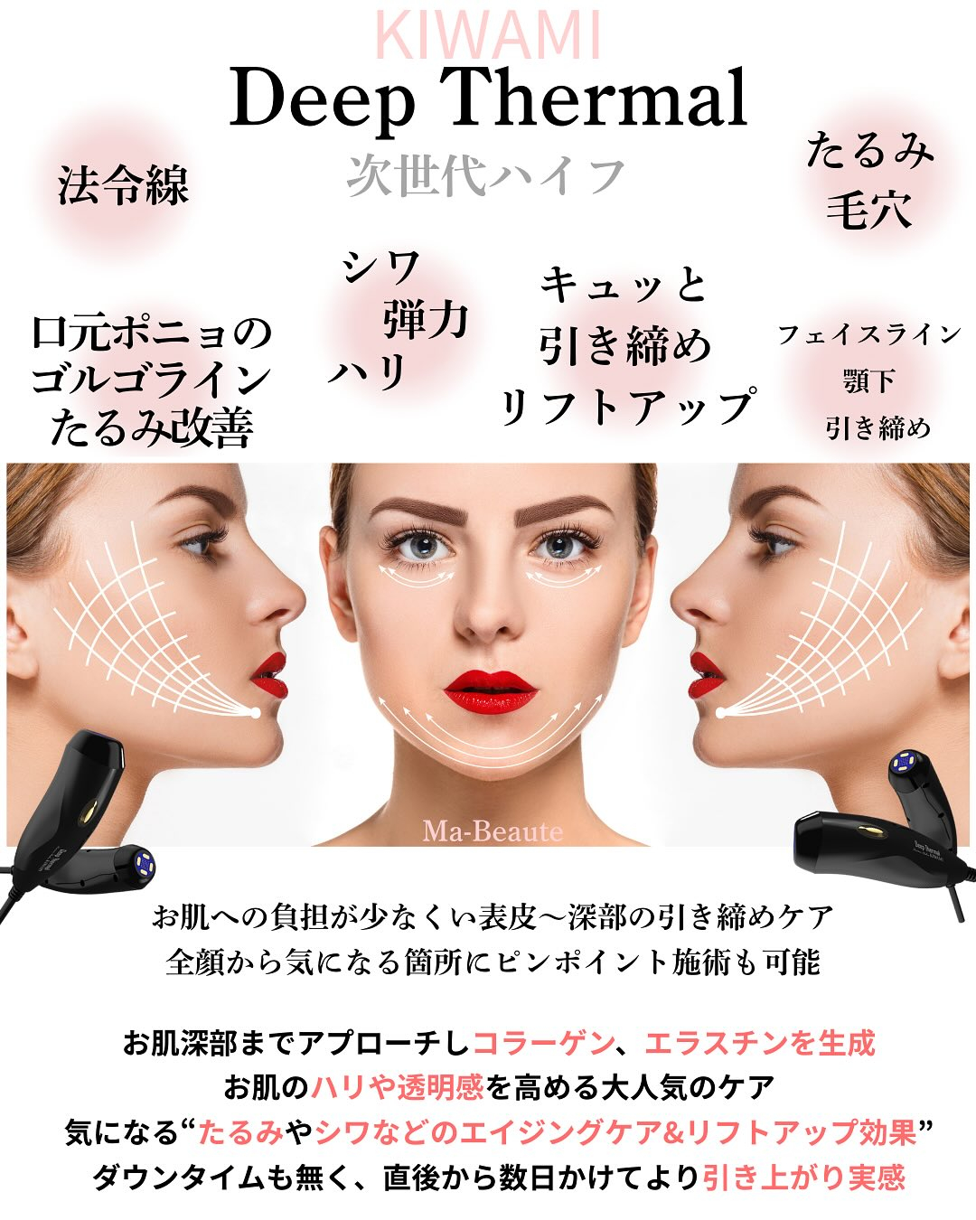 たるみ＆おシワ改善！キュッと引き締め感動の若返り術！