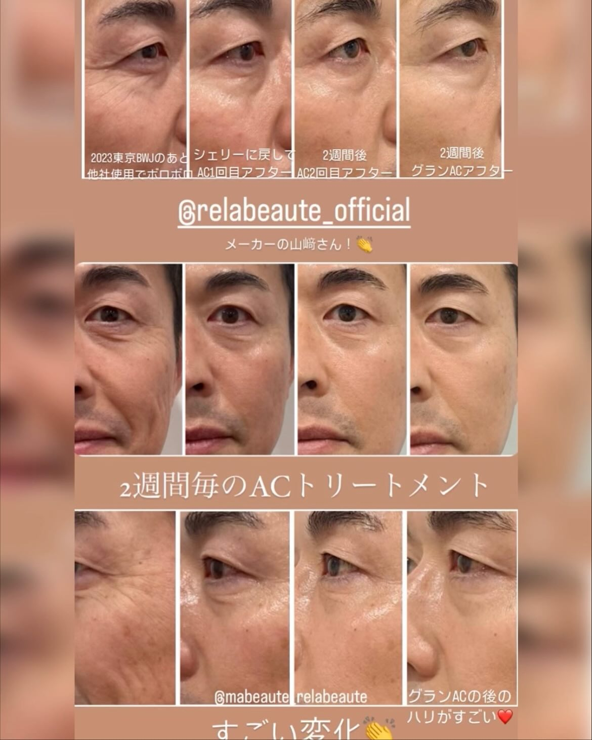 極上美肌再生❤️KIWAMI版ACトリートメントがすごい！