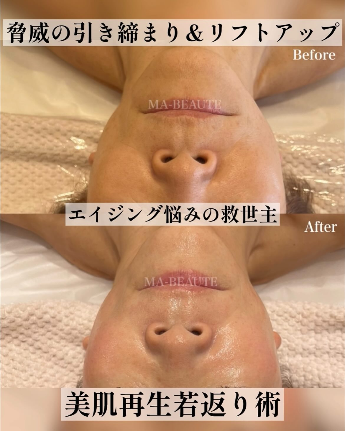 極上美肌再生❤️KIWAMI版ACトリートメントがすごい！