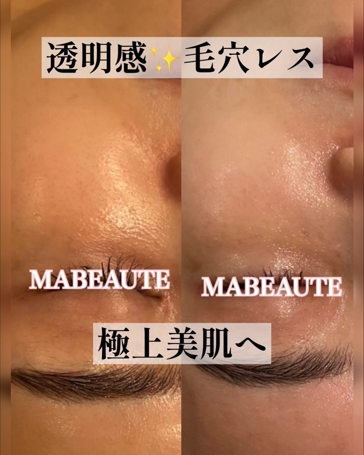 極上美肌再生❤️KIWAMI版ACトリートメントがすごい！