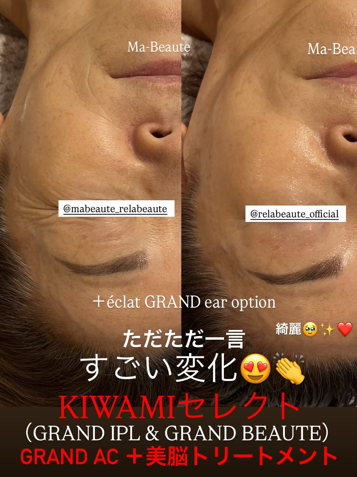リアボーテKIWAMIケアはお肌も頭皮も、精神バランスまでも...