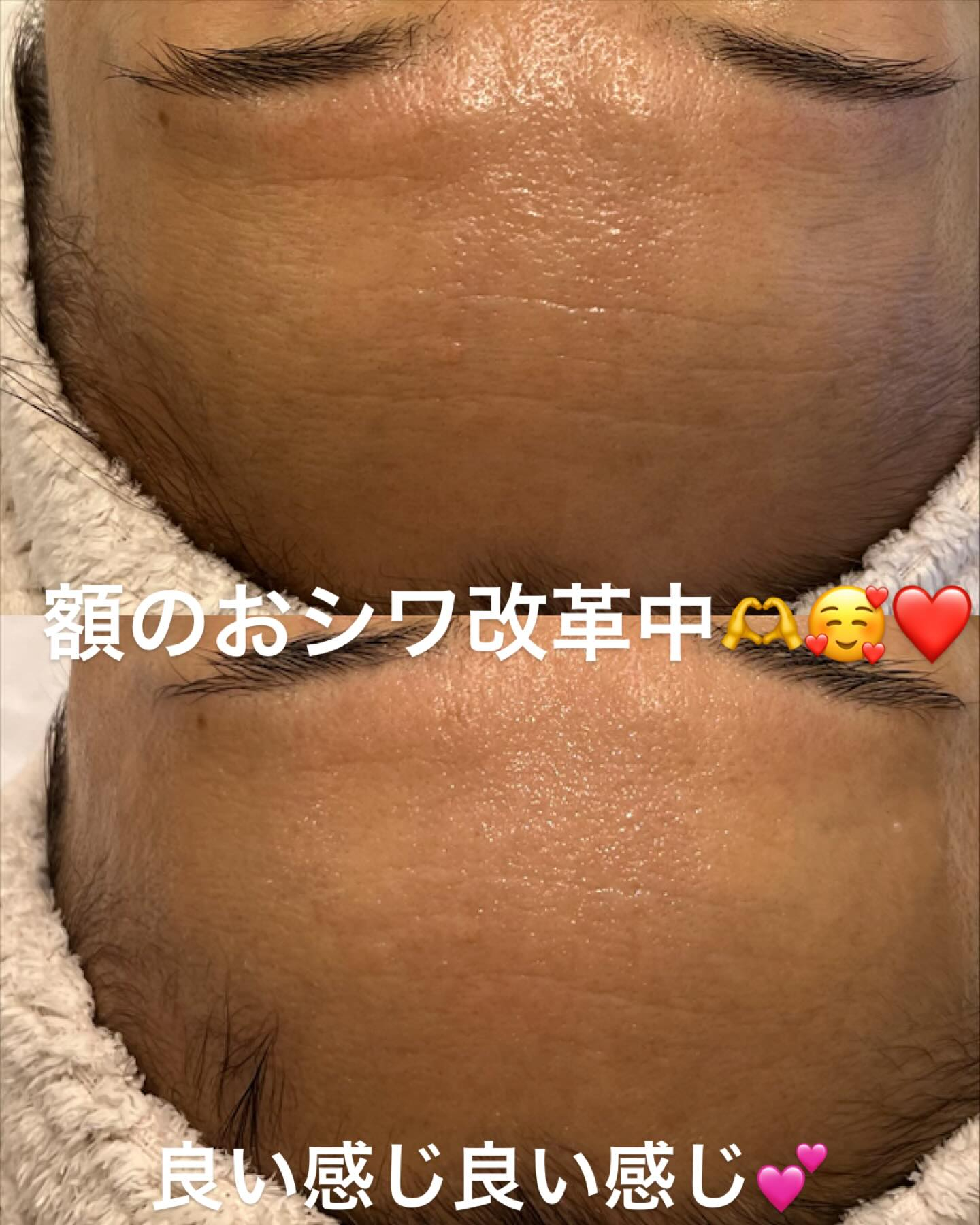 リアボーテKIWAMI❤️最高美肌に仕上げるGRANDIPL...