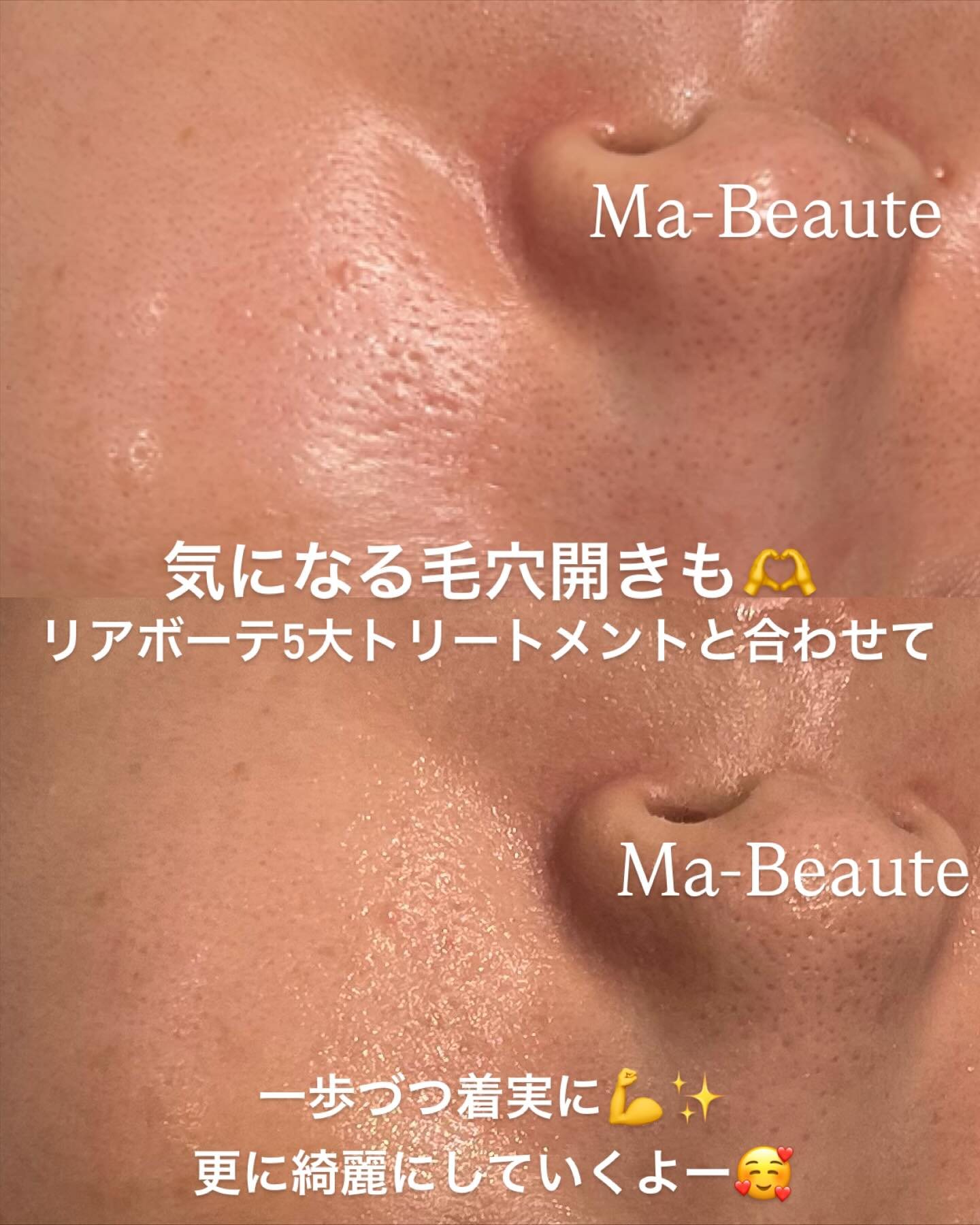 リアボーテKIWAMI❤️最高美肌に仕上げるGRANDIPL...