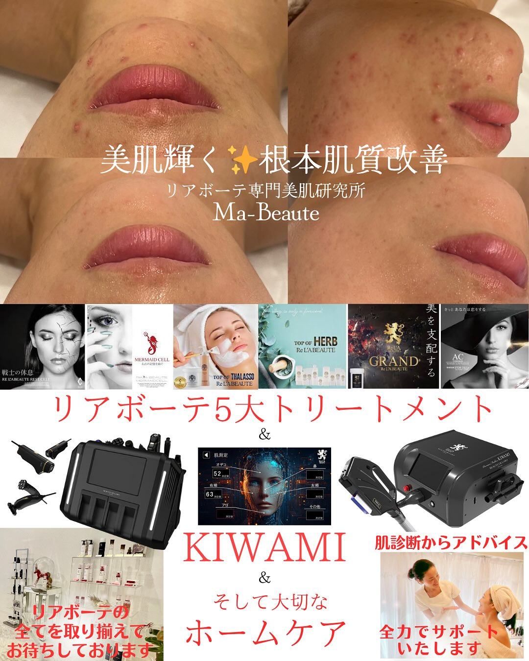 リアボーテKIWAMI❤️最高美肌に仕上げるGRANDIPL...