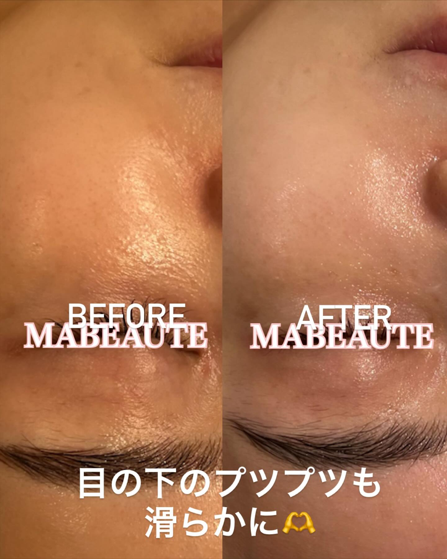 リアボーテKIWAMI❤️最高美肌に仕上げるGRANDIPL...